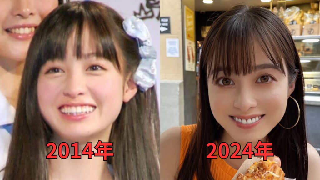 2014年と2024年の橋本環奈の歯茎の比較写真